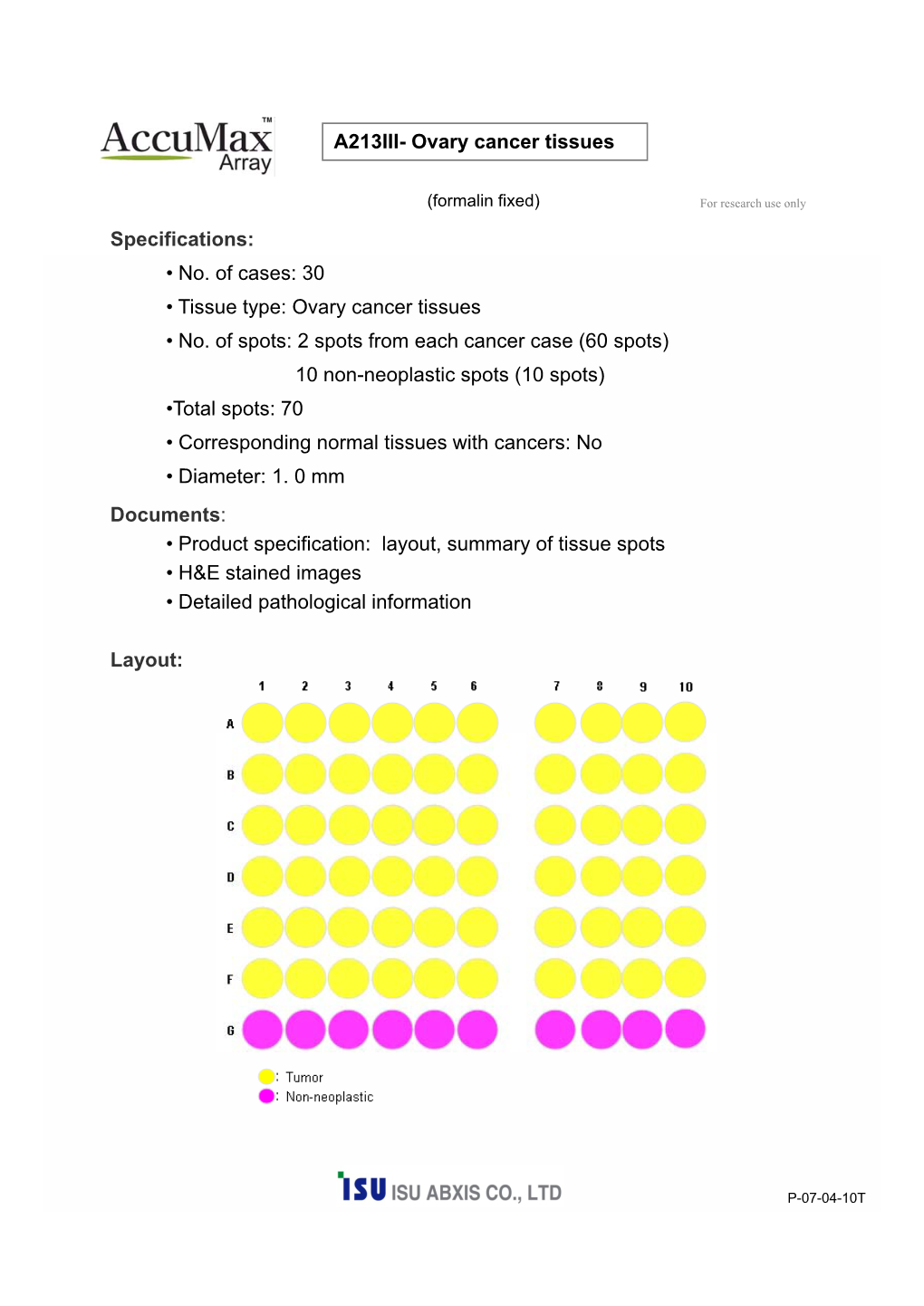 A213III- Ovary Cancer Tissues Specifications: • No. of Cases: 30