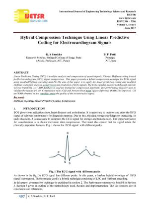 Hybrid Compression Technique Using Linear Predictive Coding for Electrocardiogram Signals
