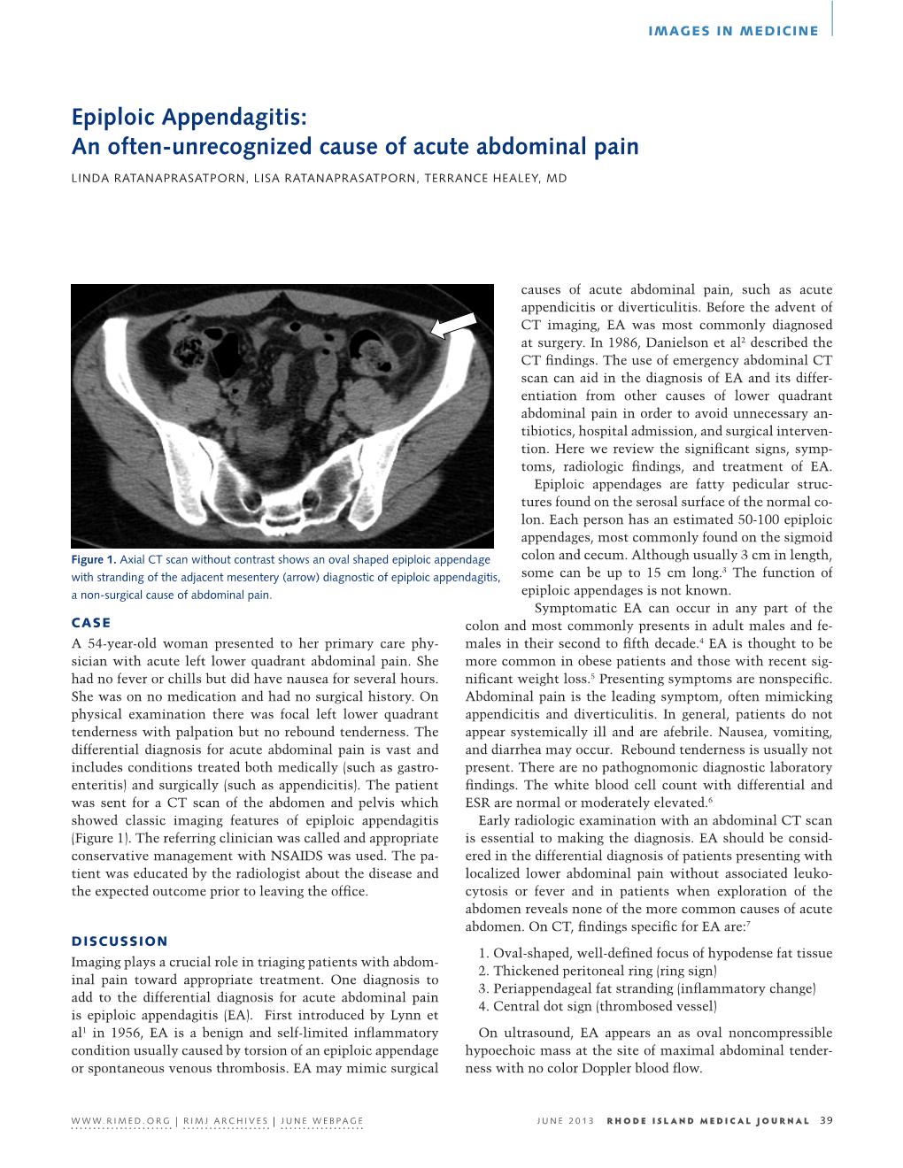 Epiploic Appendagitis: an Often-Unrecognized Cause of Acute Abdominal Pain