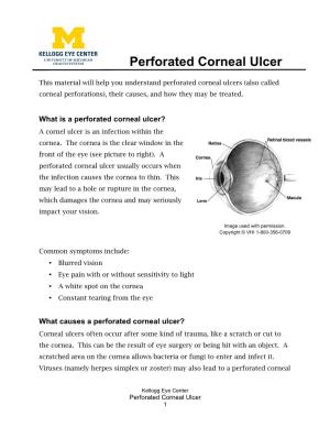 Perforated Corneal Ulcer