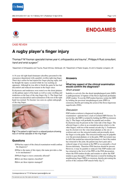 A Rugby Player's Finger Injury