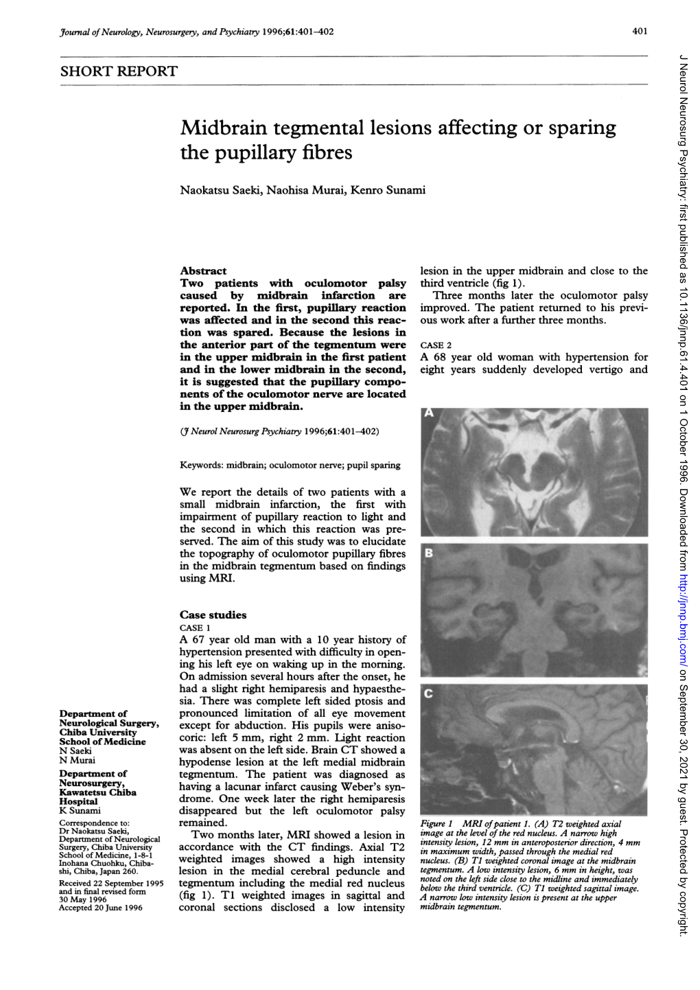 Midbrain Tegmental Lesions Affecting Or Sparing the Pupillary Fibres