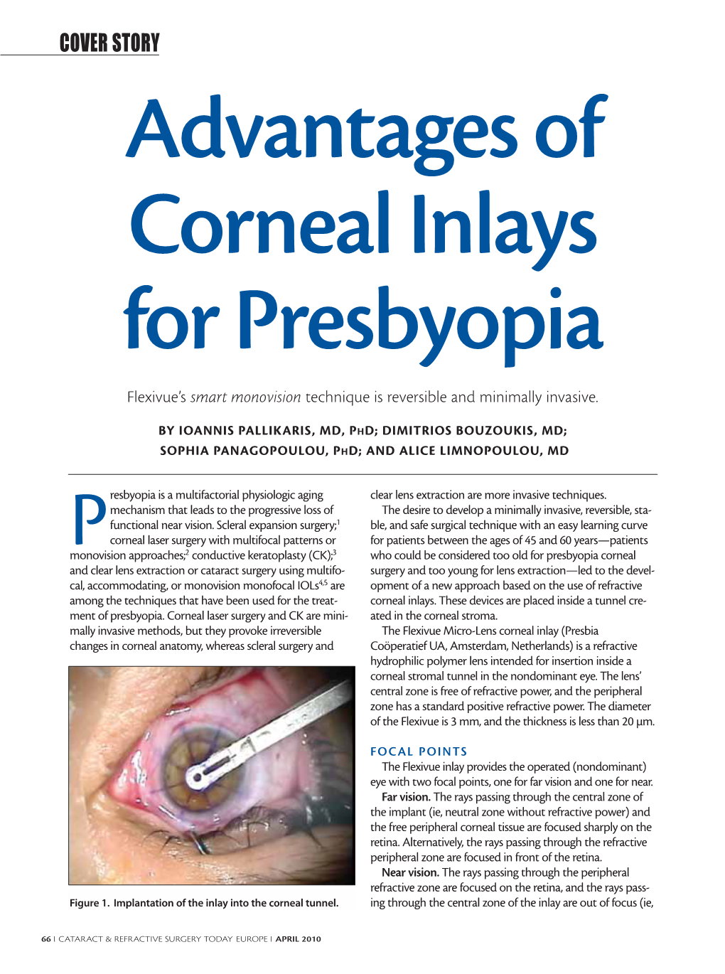 COVER STORY Advantages of Corneal Inlays for Presbyopia