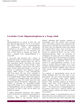 Cerebellar Cystic Oligodendroglioma in a Young Adult