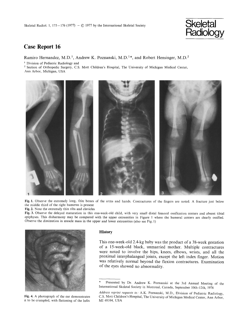 Case Report 16