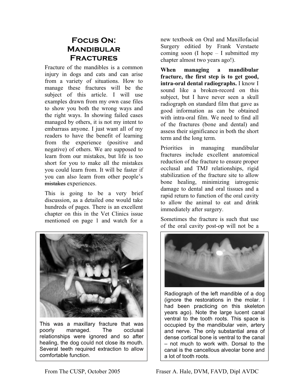 Focus On: Mandibular Fractures