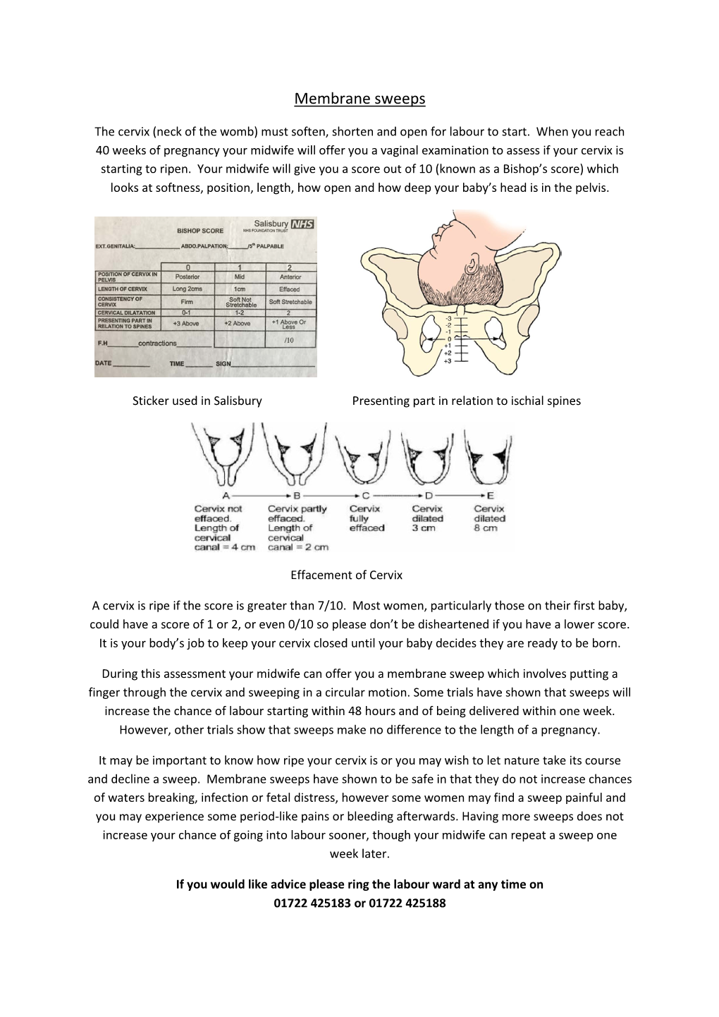 Patient Information Leaflet Membrane Sweeps.Pdf