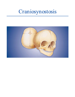 Craniosynostosis CRANIOSYNOSTOSIS