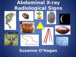 Abdominal X-Ray Radiological Signs