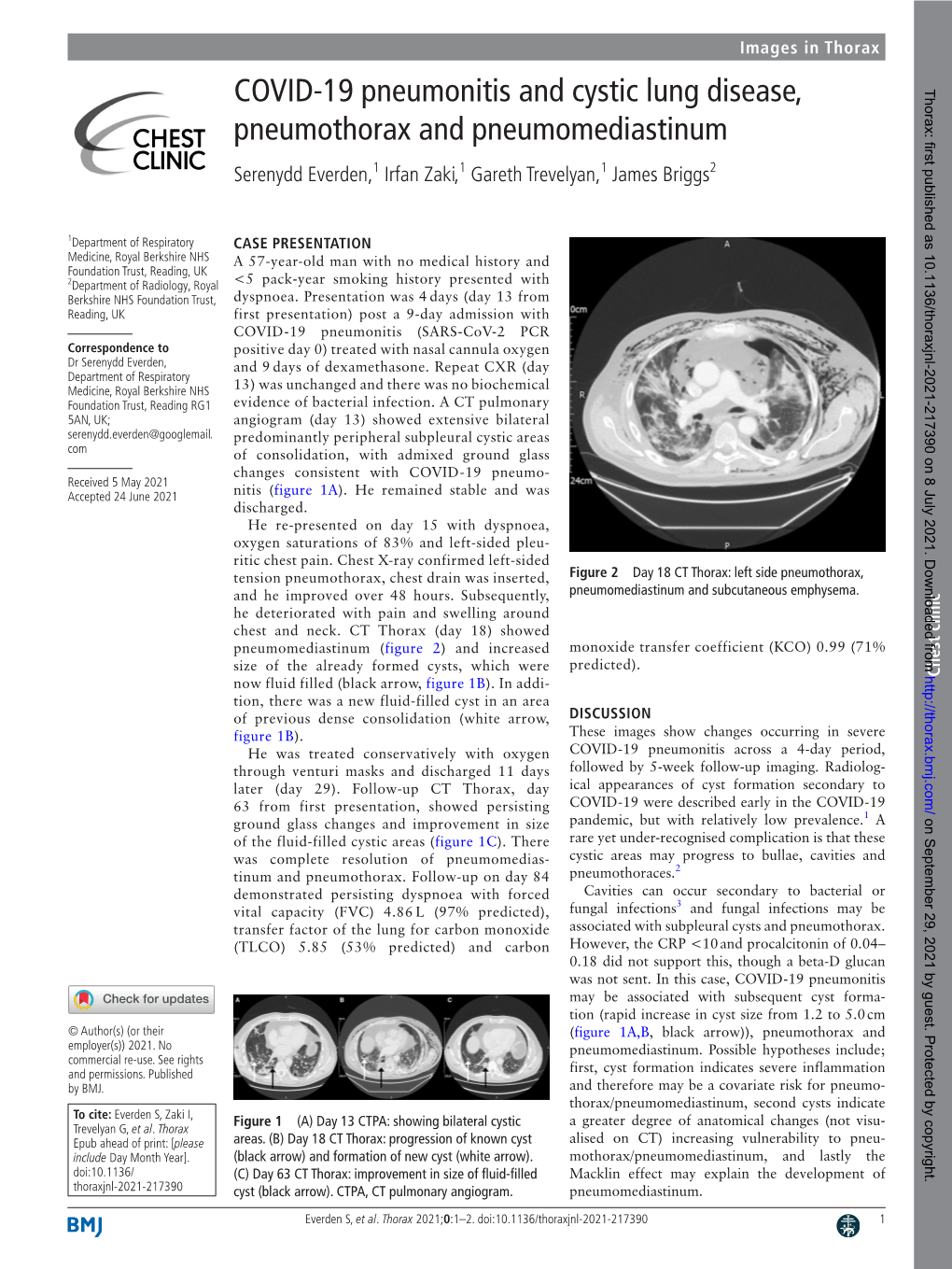 COVID-19 Pneumonitis and Cystic Lung Disease, Pneumothorax And