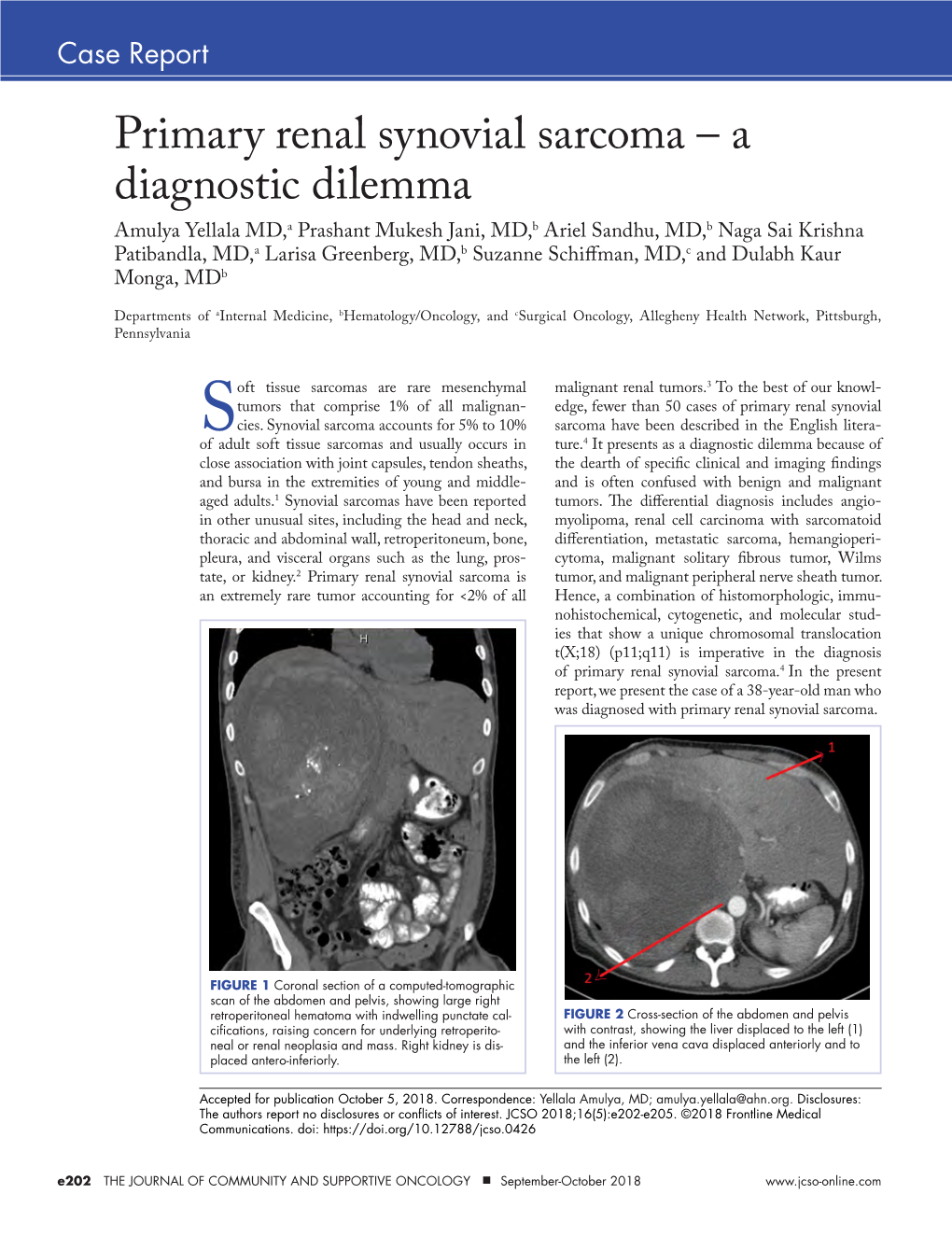 Primary Renal Synovial Sarcoma