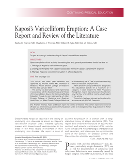 Kaposi's Varicelliform Eruption