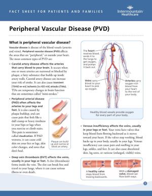Peripheral Vascular Disease (PVD) Fact Sheet