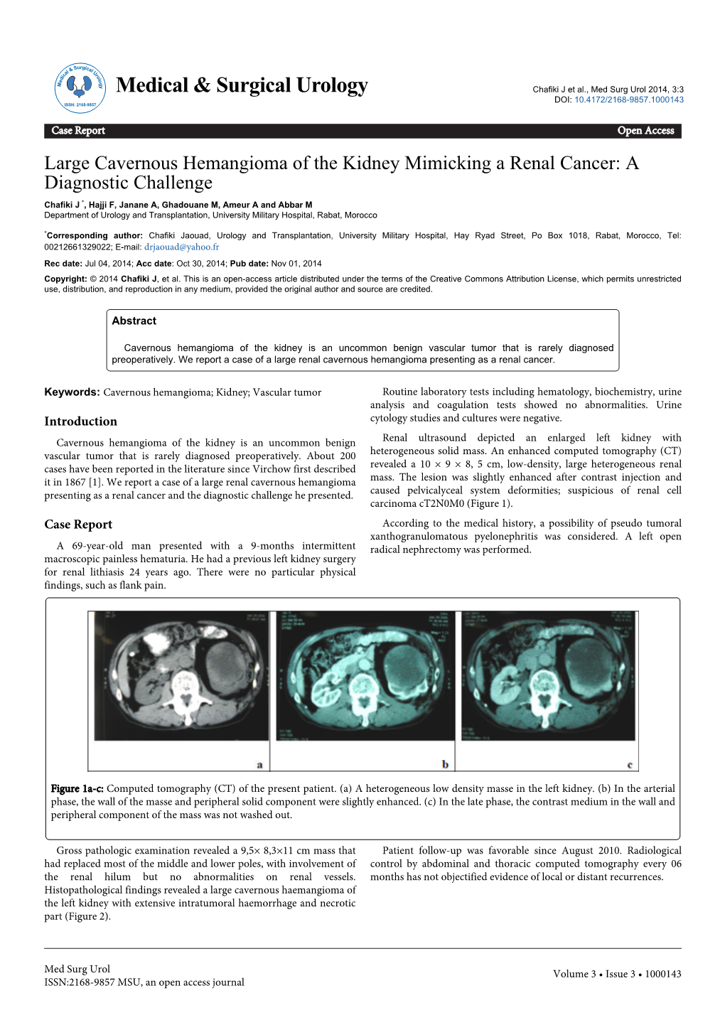 Large Cavernous Hemangioma of the Kidney Mimicking a Renal Cancer