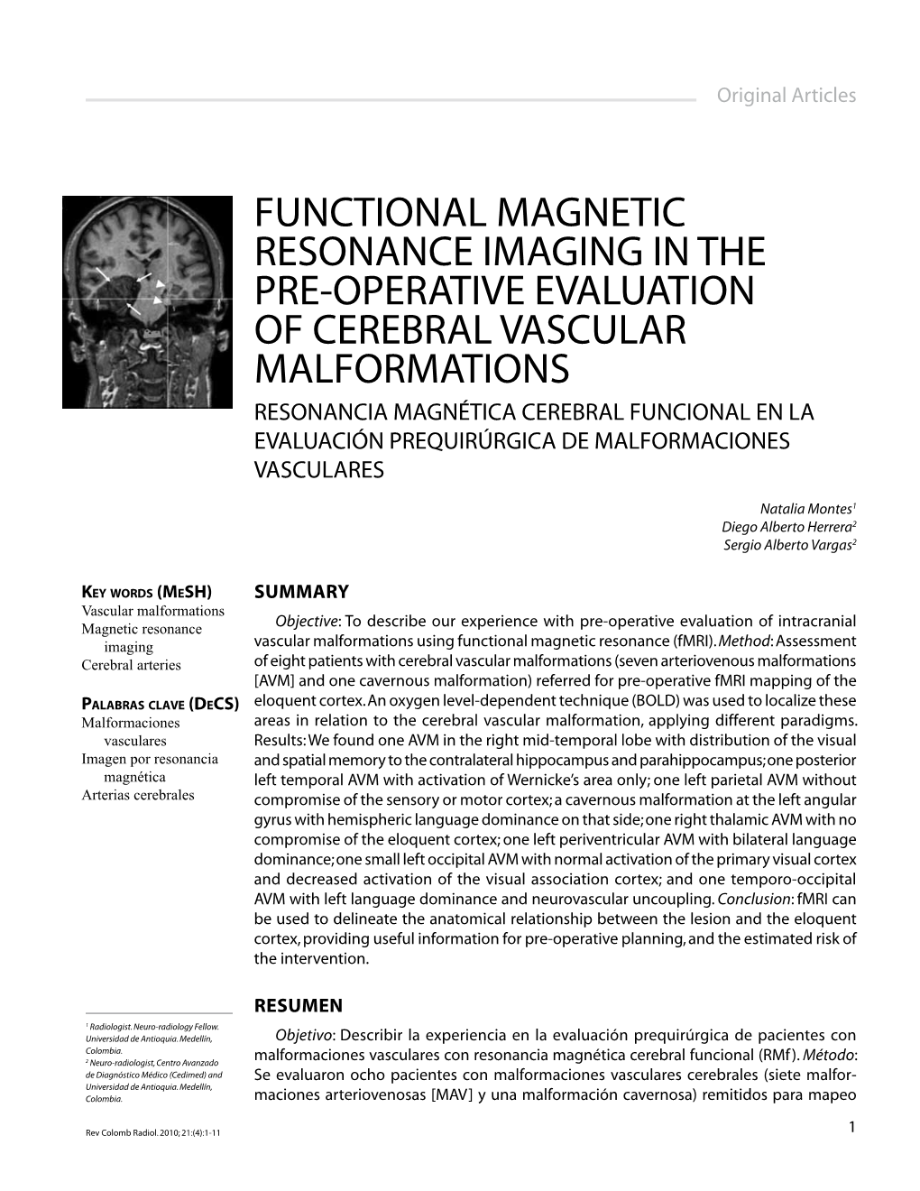 Functional Magnetic Resonance Imaging in the Pre-Operative