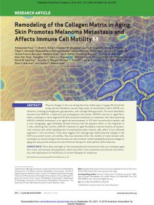 Remodeling of the Collagen Matrix in Aging Skin Promotes Melanoma Metastasis and Affects Immune Cell Motility