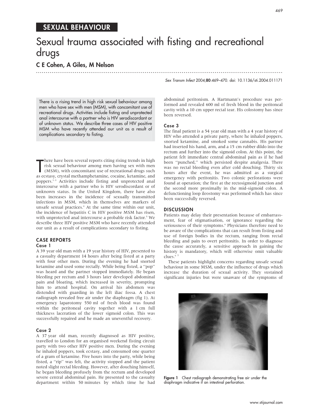 Fisting and Recreational Drugs C E Cohen, a Giles, M Nelson