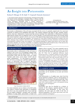An Insight Into Pericoronitis REVIEW ARTICLE