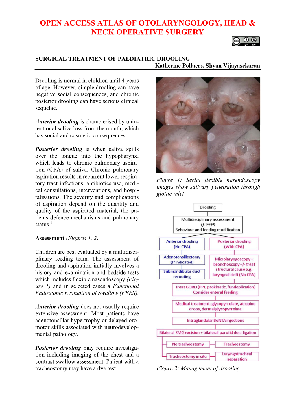 SURGICAL TREATMENT of PAEDIATRIC DROOLING Katherine Pollaers, Shyan Vijayasekaran