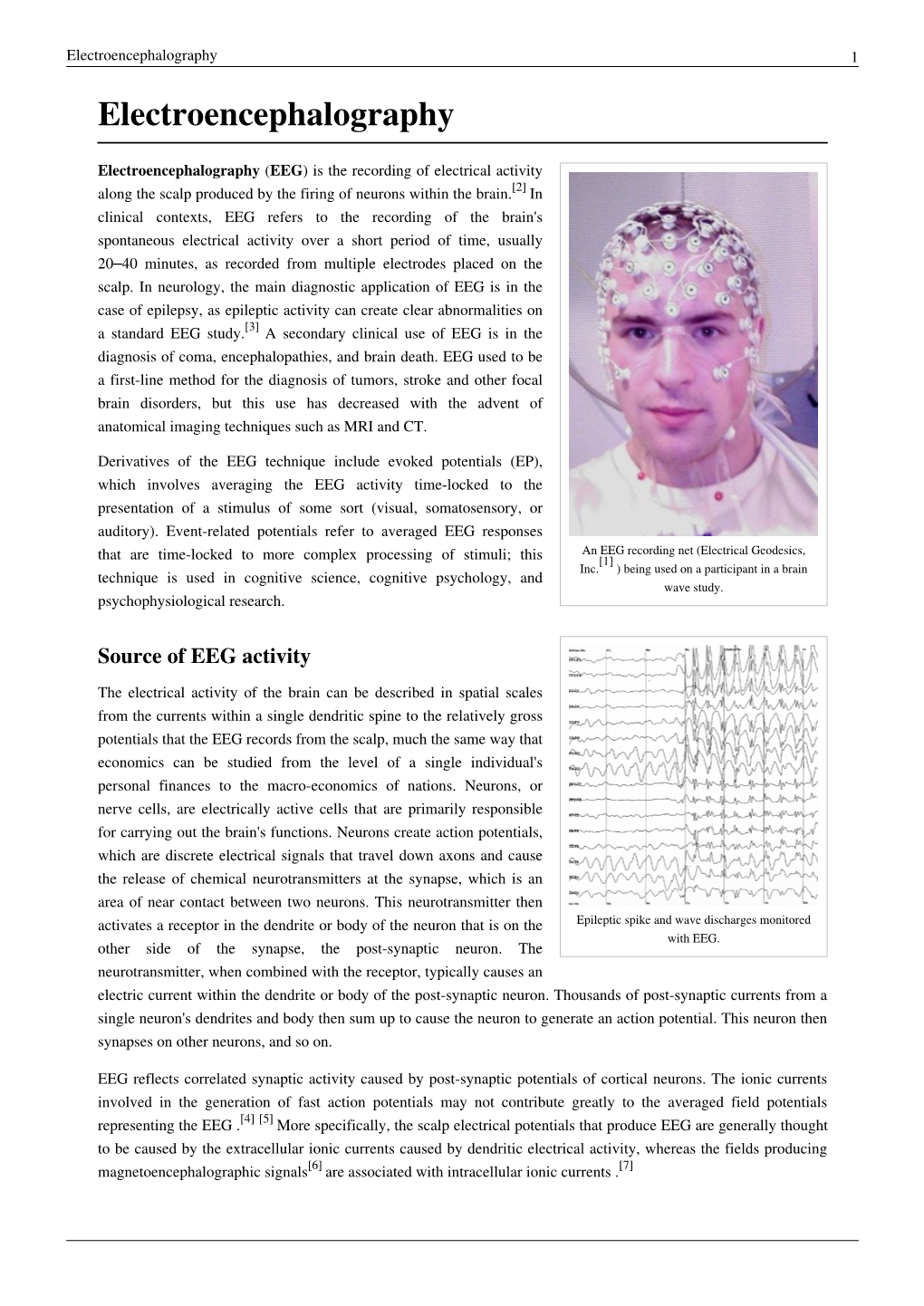 Electroencephalography (EEG)