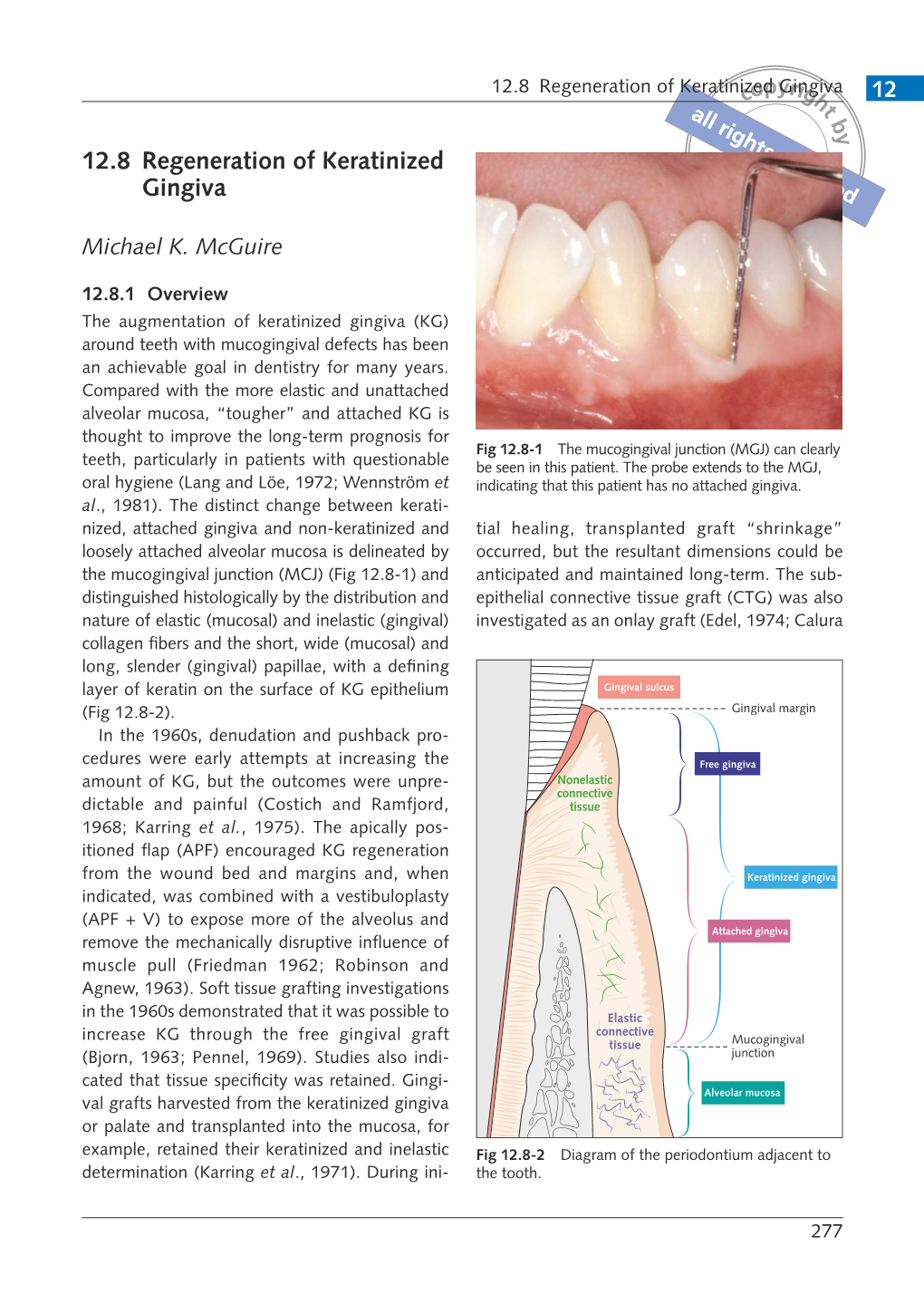 12.8 Regeneration of Keratinized Gingiva 12