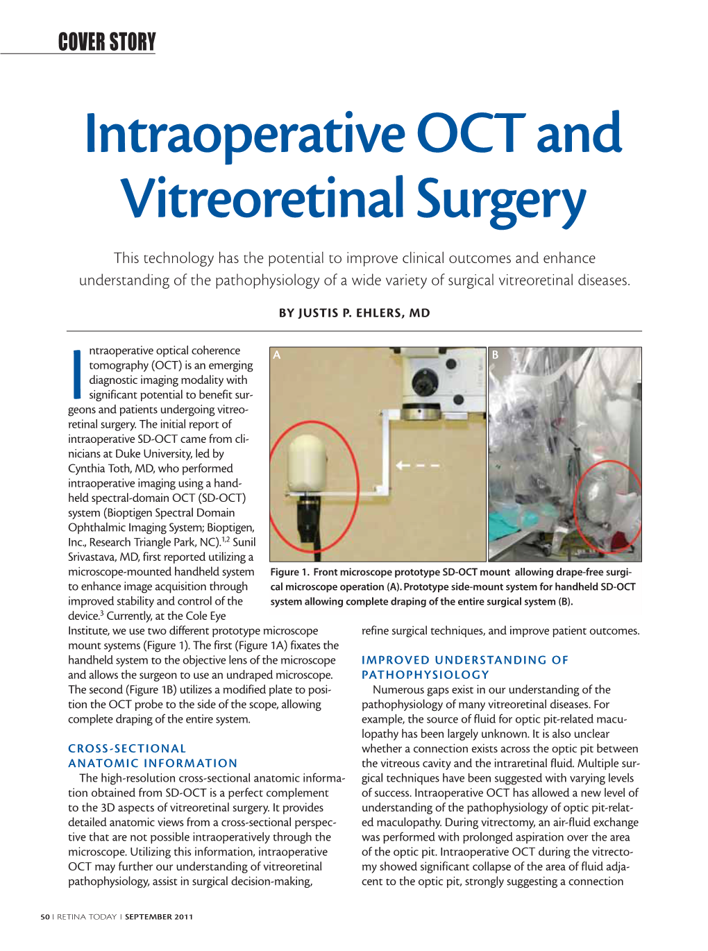 Intraoperative OCT and Vitreoretinal Surgery