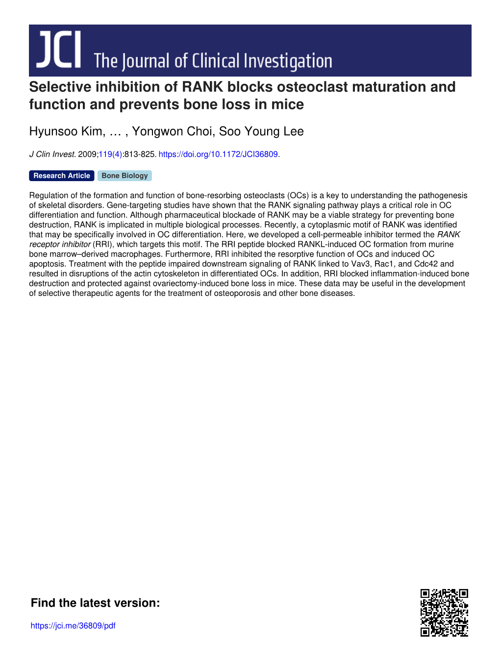 Selective Inhibition of RANK Blocks Osteoclast Maturation and Function and Prevents Bone Loss in Mice