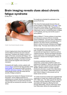 Brain Imaging Reveals Clues About Chronic Fatigue Syndrome 23 May 2014