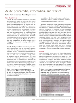 Acute Pericarditis, Myocarditis, and Worse!