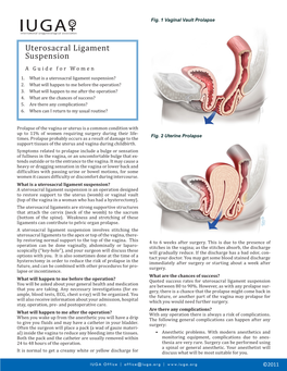 Uterosacral Ligament Suspension a Guide for Women 1
