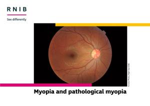 Myopia and Pathological Myopia