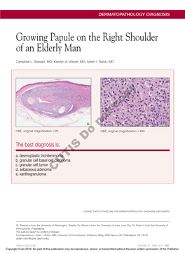 Growing Papule on the Right Shoulder of an Elderly Man