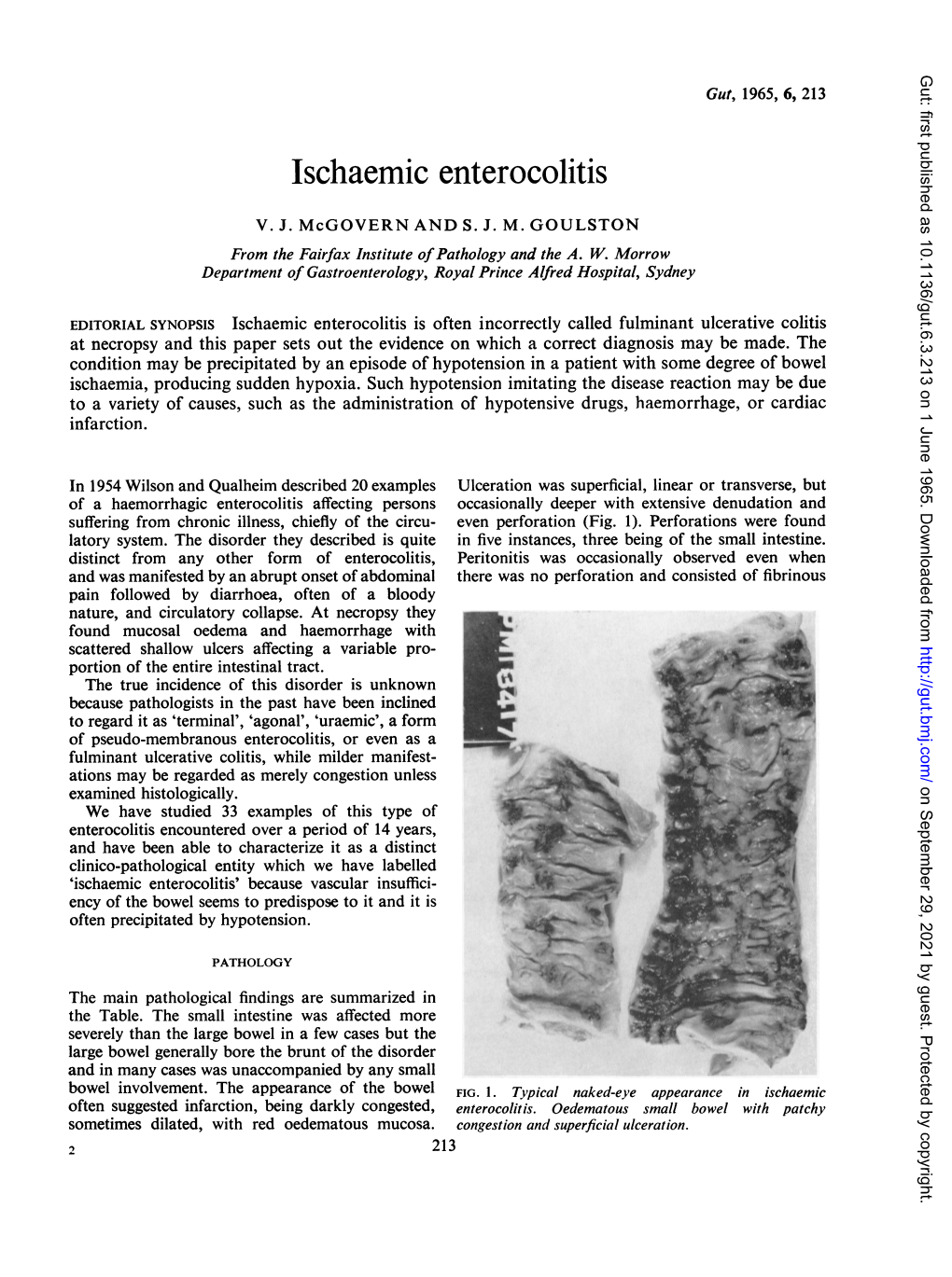 Ischaemic Enterocolitis