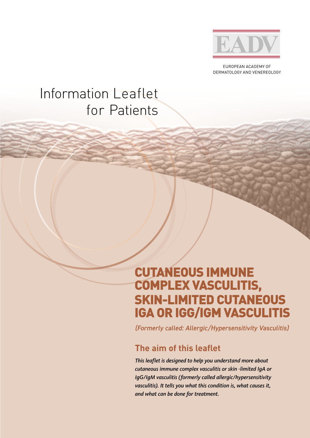 CUTANEOUS IMMUNE COMPLEX VASCULITIS, SKIN-LIMITED CUTANEOUS IGA OR IGG/IGM VASCULITIS (Formerly Called: Allergic/Hypersensitivity Vasculitis)