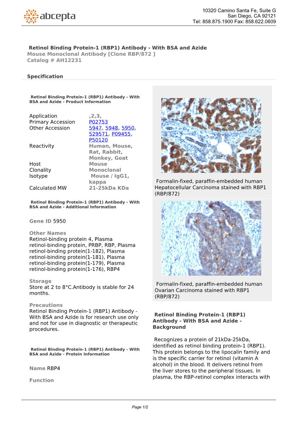 Retinol Binding Protein-1 (RBP1) Antibody - with BSA and Azide Mouse Monoclonal Antibody [Clone RBP/872 ] Catalog # AH12231