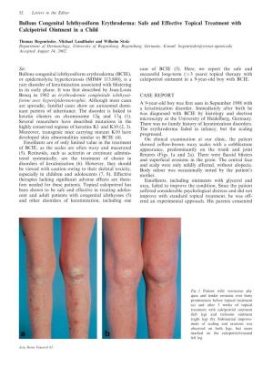 Bullous Congenital Ichthyosiform Erythroderma: Safe and Effective Topical Treatment with Calcipotriol Ointment in a Child