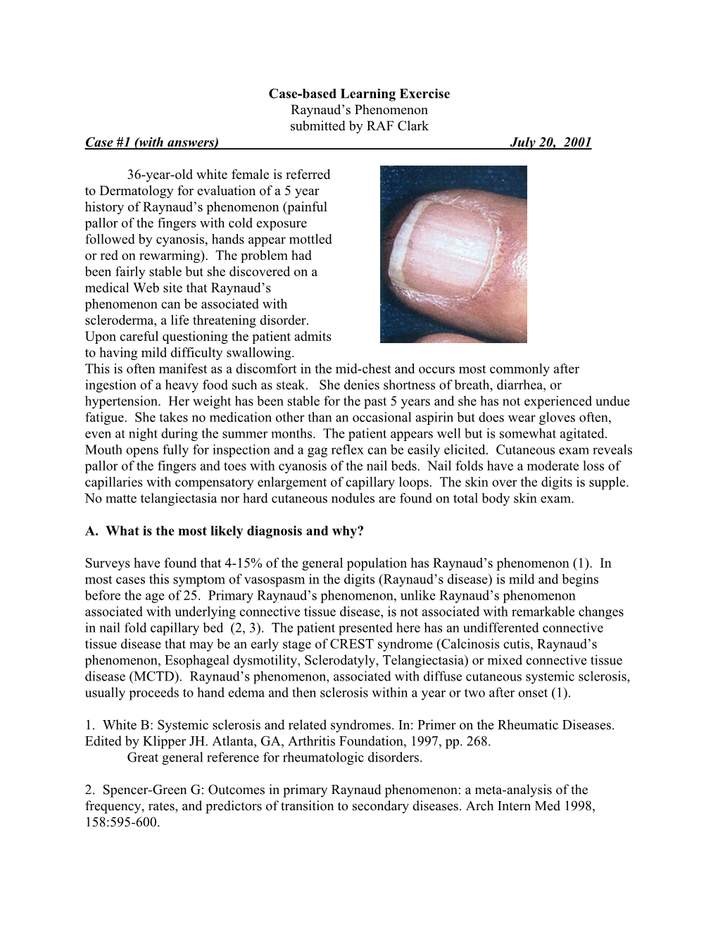 Raynaud's Phenomenon: a Longterm Prospective Study