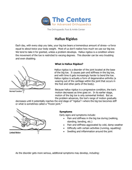 Hallux Rigidus