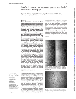 Confocal Microscopy in Cornea Guttata and Fuchs' Endothelial Dystrophy