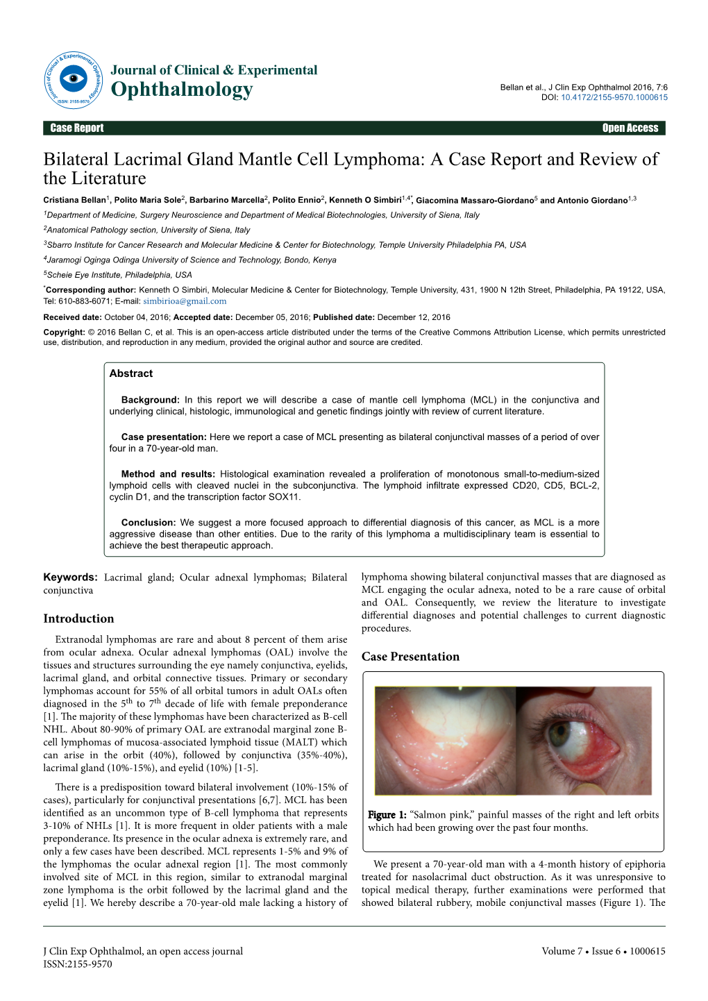 Bilateral Lacrimal Gland Mantle Cell Lymphoma: a Case Report and Review of the Literature