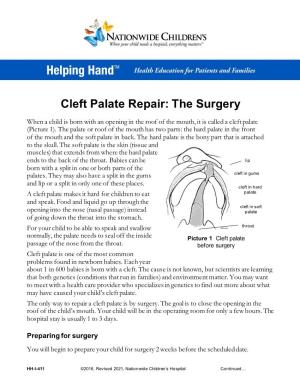 Cleft Palate Repair: the Surgery