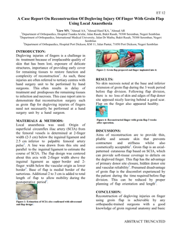A Case Report on Reconstruction of Degloving Injury of Finger with Groin Flap Using Local Anaesthesia
