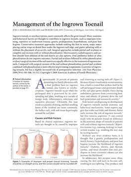 Management of the Ingrown Toenail Joel J