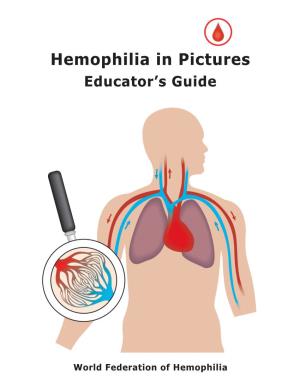 Hemophilia in Pictures Educator’S Guide