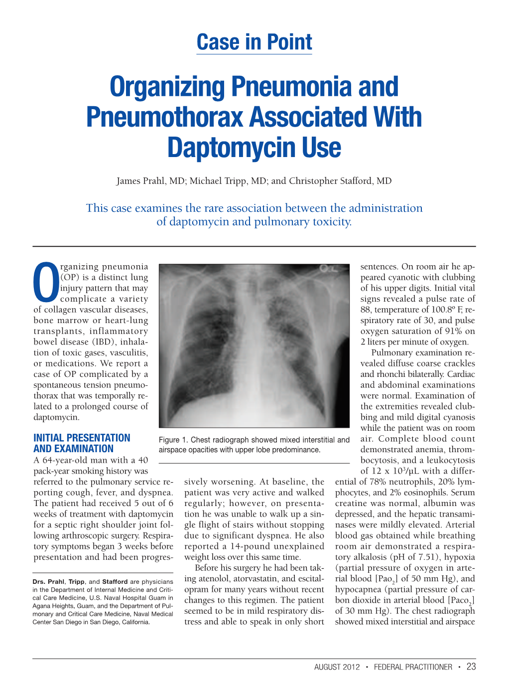 Organizing Pneumonia and Pneumothorax Associated with Daptomycin Use