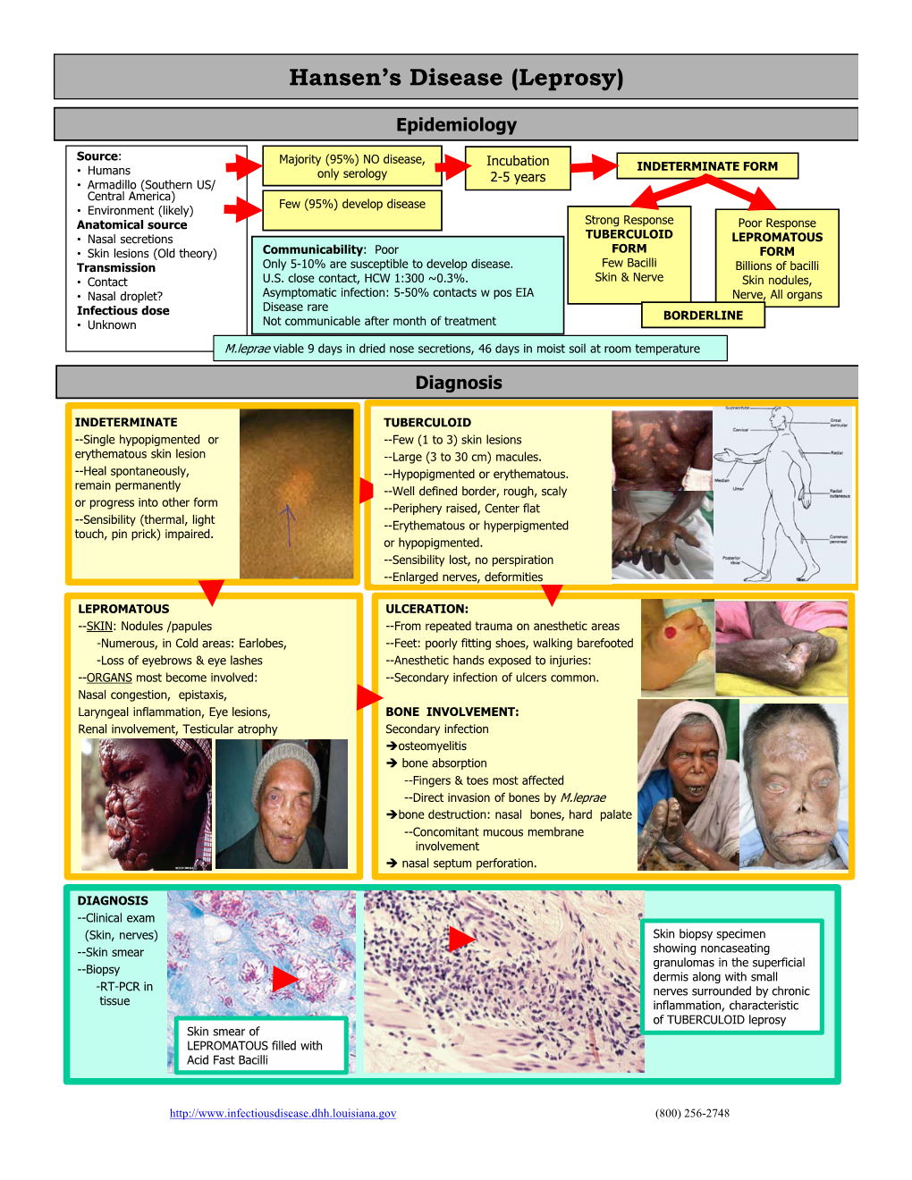 Hansen's Disease (Leprosy)