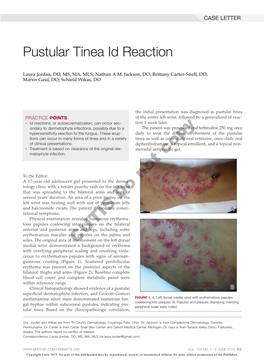 Pustular Tinea Id Reaction