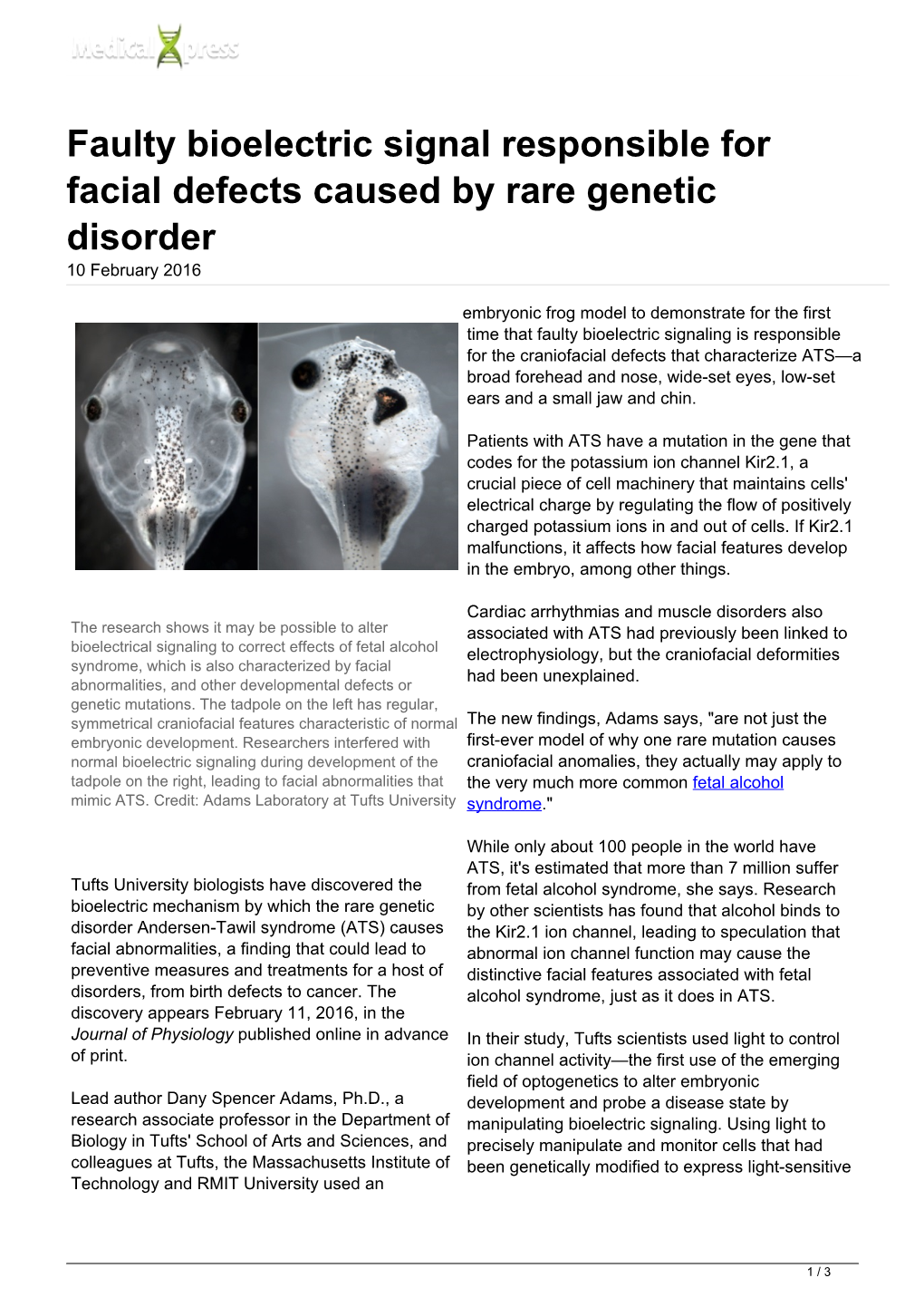 Faulty Bioelectric Signal Responsible for Facial Defects Caused by Rare Genetic Disorder 10 February 2016