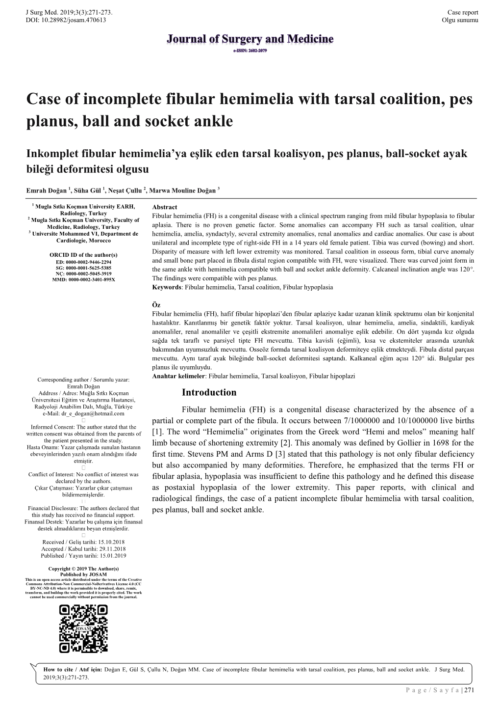 Case of Incomplete Fibular Hemimelia with Tarsal Coalition, Pes Planus, Ball and Socket Ankle