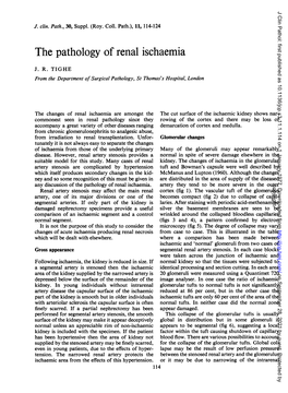 The Pathology of Renal Ischaemia